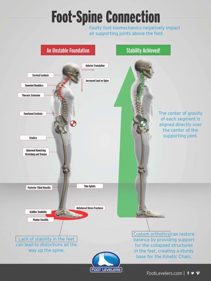 foot orthotics, spine alignment, pain management